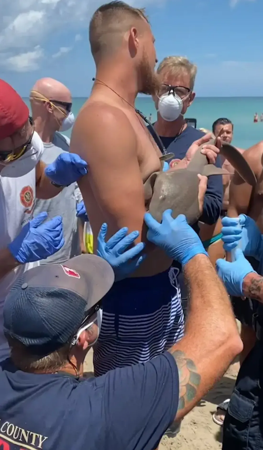 Morsure de Requin sur un homme serein